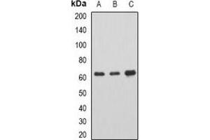 Western blot analysis of AHCYL1 expression in SKOV3 (A), mouse brain (B), rat spinal cord (C) whole cell lysates.