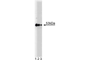 Western Blotting (WB) image for anti-Protein Kinase, CAMP-Dependent, Regulatory, Type II, beta (PRKAR2B) (AA 1-418) antibody (ABIN968073) (PRKAR2B Antikörper  (AA 1-418))