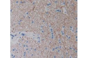 Used in DAB staining on fromalin fixed paraffin- embedded Kidney tissue (Neurotrypsin Antikörper  (AA 17-235))