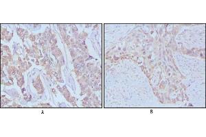 Immunohistochemical analysis of paraffin-embedded human breast cancer,Lung breast tissues using EGF mouse mAb (EGF Antikörper)