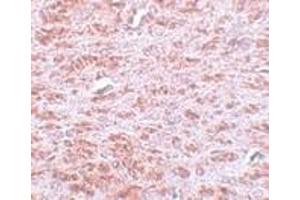 Immunohistochemistry of CDX2 in rat brain tissue with CDX2 antibody at 5 μg/ml. (CDX2 Antikörper  (C-Term))