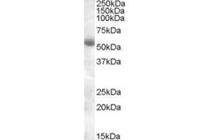 ABIN570926 (0. (TMPRSS2 Antikörper  (Internal Region))
