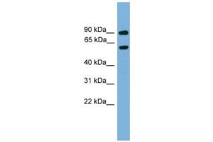 WB Suggested Anti-Nab2 Antibody Titration:  0.