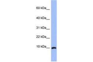 ACBD7 Antikörper  (N-Term)