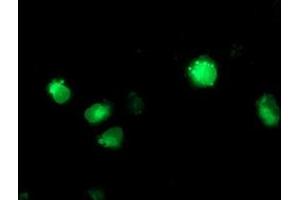 Anti-CYP2C9 mouse monoclonal antibody (ABIN2455199) immunofluorescent staining of COS7 cells transiently transfected by pCMV6-ENTRY CYP2C9 (RC220997). (CYP2C9 Antikörper)