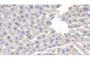 Detection of CP in Rat Liver Tissue using Polyclonal Antibody to Ceruloplasmin (CP) (Ceruloplasmin Antikörper  (AA 872-1059))