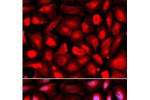 Immunofluorescence analysis of U2OS cells using ETS1 Polyclonal Antibody (ETS1 Antikörper)
