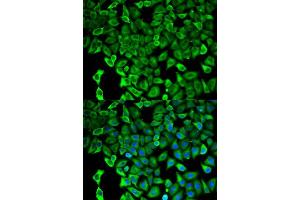 Immunofluorescence analysis of HeLa cell using PSMD2 antibody.