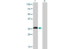 Western Blot analysis of MYOG expression in transfected 293T cell line by MYOG monoclonal antibody (M01), clone 2B7.