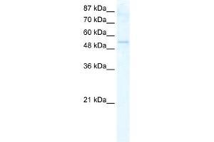 WB Suggested Anti-DDX19A Antibody Titration:  2. (DDX19A Antikörper  (N-Term))