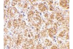 Immunohistochemistry of DARC in mouse brain tissue with DARC antibody at 2. (DARC Antikörper  (C-Term))