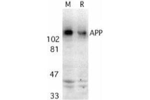 Western blot analysis of APP in mouse (M) and rat (R) brain tissue lysates with AP30071PU-N APP antibody at 2 μg/ml. (APP Antikörper  (C-Term))