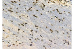 ABIN6263046 and ABIN6272340 at 1/100 staining Rat brain tissue by IHC-P. (CHRM4 Antikörper  (Internal Region))