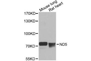 Western blot analysis of extracts of various cell lines, using ND5 antibody (ABIN6294088) at 1:1000 dilution. (MT-ND5 Antikörper)