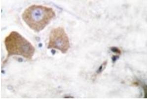 Image no. 2 for anti-Microtubule-Associated Protein tau (MAPT) (pSer396) antibody (ABIN318142) (MAPT Antikörper  (pSer396))