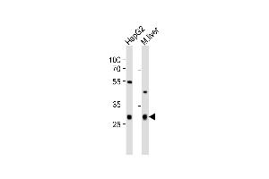 Western blot analysis of lysates from HepG2 cell line, mouse liver tissue lysate (from left to right), using CTDSP1 Antibody (N-term) (ABIN6243354 and ABIN6577527). (CTDSP1 Antikörper  (N-Term))