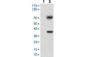 Western blot analysis of Lane 1: Negative control [HEK293 cell lysate]; Lane 2: Over-expression lysate [TUBE1 (AA: 314-472)-hIgGFc transfected HEK293 cells] with TUBE1 monoclonal antibody, clone 7G3B2  at 1:500-1:2000 dilution. (TUBE1 Antikörper  (AA 314-472))