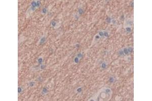 IHC-P analysis of Human Tissue, with DAB staining. (GRIP1 Antikörper  (AA 79-268))
