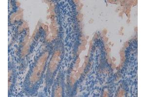 Immunohistochemistry (IHC) image for anti-Keratin 20 (KRT20) (AA 75-382) antibody (ABIN5013827)