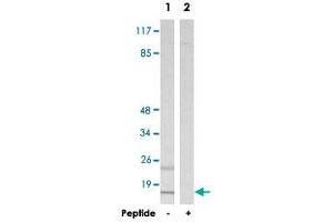 Western blot analysis of extracts from HepG2 cells, using MRPS16 polyclonal antibody . (MRPS16 Antikörper)
