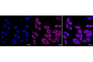 anti-Pumilio Homolog 1 (PUM1) antibody