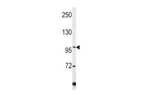 Western blot analysis of COL6A1 antibody (C-term) (ABIN390513 and ABIN2840867) in Y79 cell line lysates (35 μg/lane). (COL6A1 Antikörper  (C-Term))