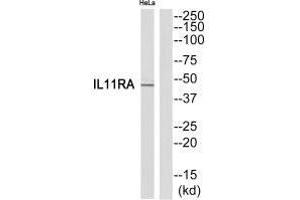 Western blot analysis of extracts from HeLa cells, using IL11RA antibody. (IL11RA Antikörper  (C-Term))