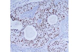 Immunohistochemistry (IHC) image for anti-Protein Kinase, DNA-Activated, Catalytic Polypeptide (PRKDC) antibody (ABIN6241643)