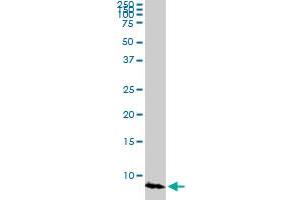 ATOX1 monoclonal antibody (M03A), clone 3D10. (ATOX1 Antikörper  (AA 1-68))
