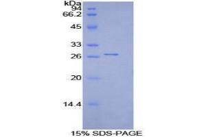 SDS-PAGE (SDS) image for Integrin beta 2 (ITGB2) (AA 431-652) protein (His tag) (ABIN2125334)