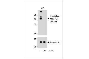 Western Blotting (WB) image for anti-Methyl CpG Binding Protein 2 (MECP2) (pSer423) antibody (ABIN650833)