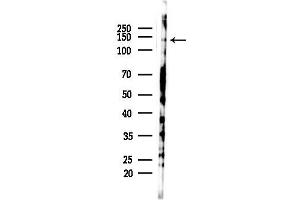 Western blot analysis of lysates from PC12 cells(starvation 24h treatment), using USP40 Antibody at 1/1000 dilution.