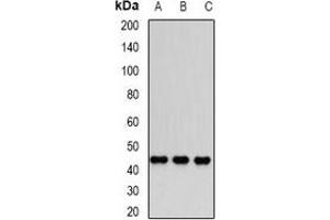 Western blot analysis of Dnmt3L expression in PC3 (A), Jurkat (B), MCF7 (C) whole cell lysates.