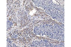 IHC analysis of GFPT1 using anti-GFPT1 antibody (ABIN7602887). (GFPT1 Antikörper  (C-Term))