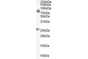 Western Blotting (WB) image for anti-Chromodomain Protein, Y-Like (CDYL) (C-Term) antibody (ABIN2465195) (CDYL Antikörper  (C-Term))