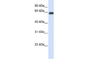 SLC39A4 antibody used at 1 ug/ml to detect target protein. (SLC39A4 Antikörper)