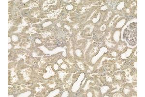 ABIN6258467 and ABIN6275239 at 1/100 staining human normal kidney tissue by IHC-P. (MRPS36 Antikörper  (Internal Region))
