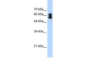 ALPP antibody used at 1. (PLAP Antikörper)