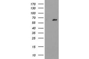 Western Blotting (WB) image for anti-Glucokinase (Hexokinase 4) Regulator (GCKR) antibody (ABIN1498414) (GCKR Antikörper)