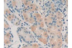 Immunohistochemistry (IHC) image for anti-Heat Shock Factor Protein 1 (HSF1) (AA 15-288) antibody (ABIN7431782)