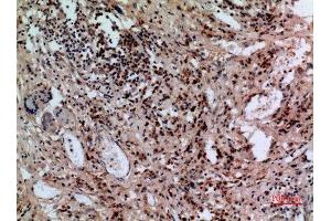 Immunohistochemistry (IHC) analysis of paraffin-embedded Human Lung, antibody was diluted at 1:100. (SLC10A1 Antikörper  (C-Term))