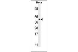 Western blot analysis of FOXL2 Antibody (N-term) in Hela cell line lysates (35ug/lane).