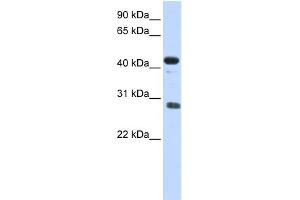 WB Suggested Anti-CDCA5 Antibody Titration: 0. (CDCA5 Antikörper  (Middle Region))