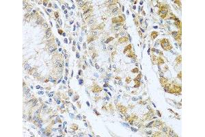 Immunohistochemistry of paraffin-embedded Human stomach using RNASE13 Polyclonal Antibody at dilution of 1:100 (40x lens). (RNASE13 Antikörper)