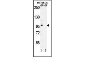 Western blot analysis of PDPR Antibody (C-term) Cat. (PDPR Antikörper  (C-Term))