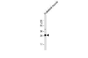 Anti-DNASE1L2 Antibody (C-Term) at 1:2000 dilution + human skeletal muscle lysate Lysates/proteins at 20 μg per lane. (DNASE1L2 Antikörper  (AA 199-229))