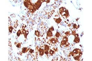 IHC testing of FFPE human pituitary gland with ACTH antibody (clone ADCT1-1). (CLIP Antikörper  (AA 25-39))