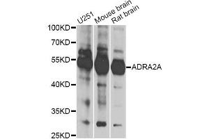 Western blot analysis of extracts of various cell lines, using ADRA2A antibody (ABIN6291251) at 1:1000 dilution. (ADRA2A Antikörper)