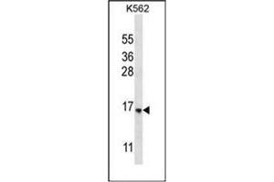 Western blot analysis of STARD5 Antibody (N-term) in K562 cell line lysates (35ug/lane). (STARD5 Antikörper  (N-Term))