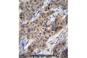Immunohistochemistry (Paraffin-embedded Sections) (IHC (p)) image for anti-Transforming Growth Factor, beta 1 (TGFB1) (AA 29-58), (N-Term) antibody (ABIN955174)